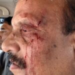 शिक्षा निदेशक से मारपीट, शिक्षक संघ आग बबूला