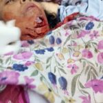 पौड़ी: वन मंत्री के गृह क्षेत्र में गुलदार का फिर हमला, महिला घायल